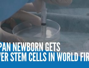 Japanese newborn gets liver stem cell transplant in world first